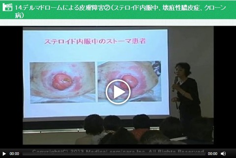 stoma_skincare14