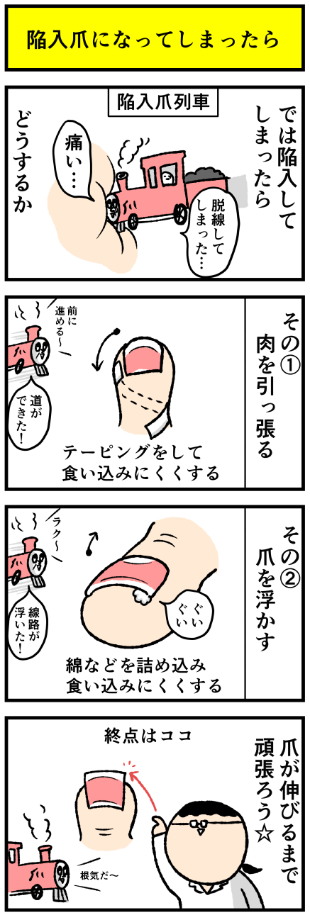 301tume2
