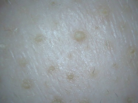 2017-04-27-12-00-45