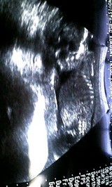 32b17fb5.jpg