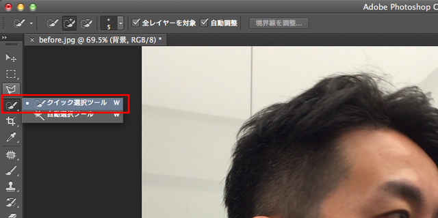 11のコピー