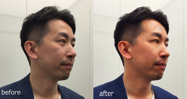 before_after