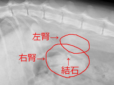 腎臓XP