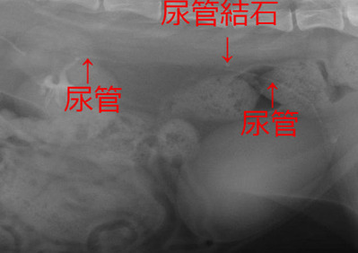 尿管造影
