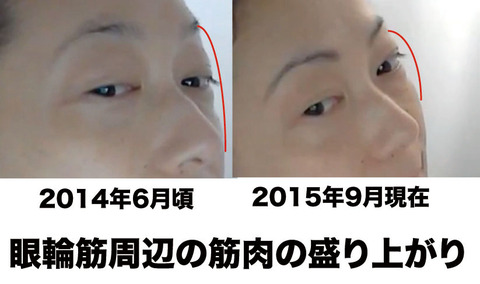 眼輪筋比較図3