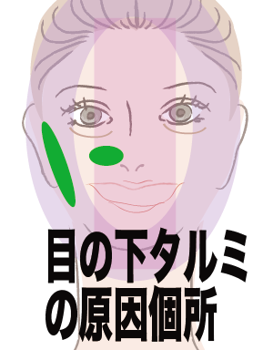 mesisisi