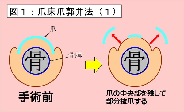 爪床爪郭弁法-01