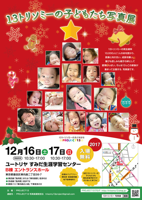 trisomy13Exhibition_201712_web