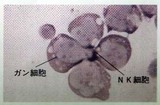 NKとガンの写真