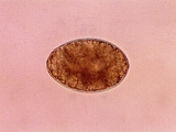 125_egg.jpg