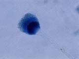 130_eardischarge.jpg