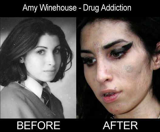 amywinehouse_before_after_drugs.jpg