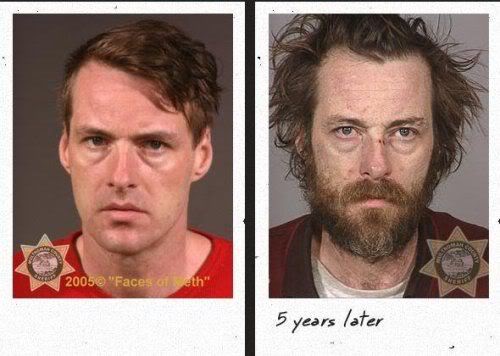 before_after_drugs_09.jpg