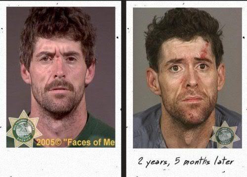 before_after_drugs_03.jpg