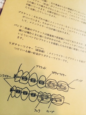 は