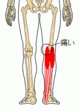 腓腹筋