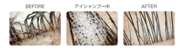 アイしゃんぷー