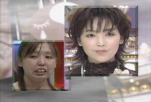 ビューティコロシアム