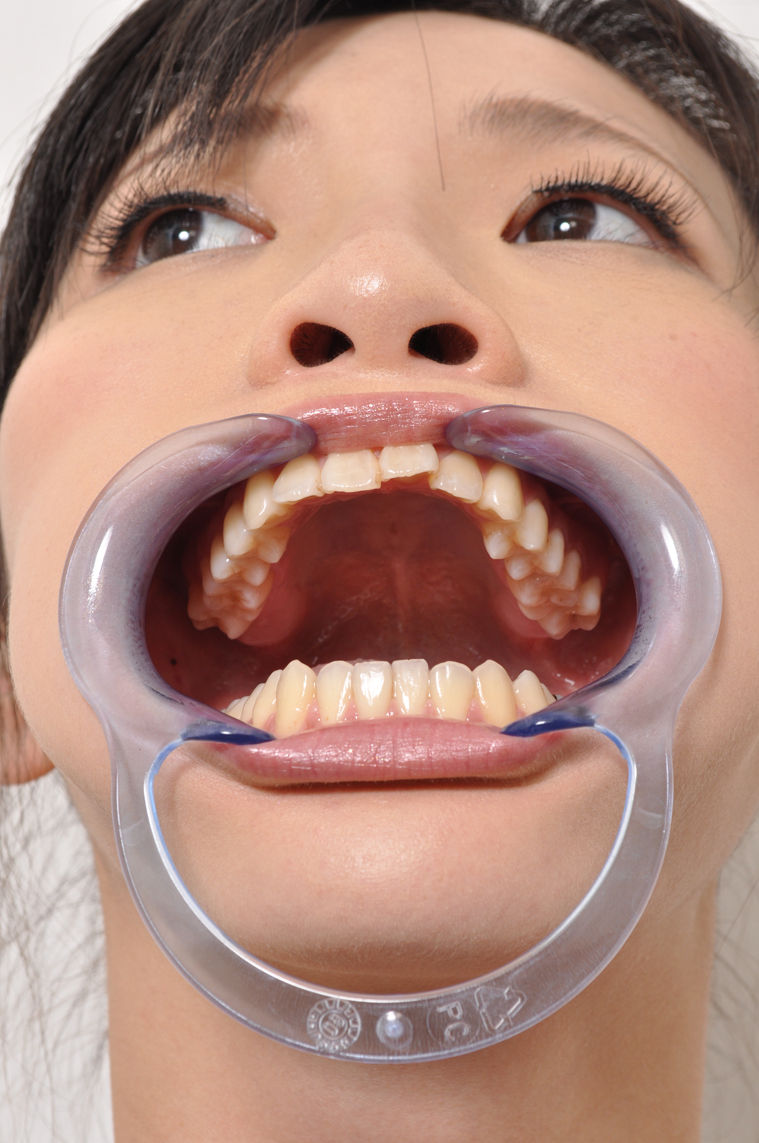 Dental Gag Porn 69