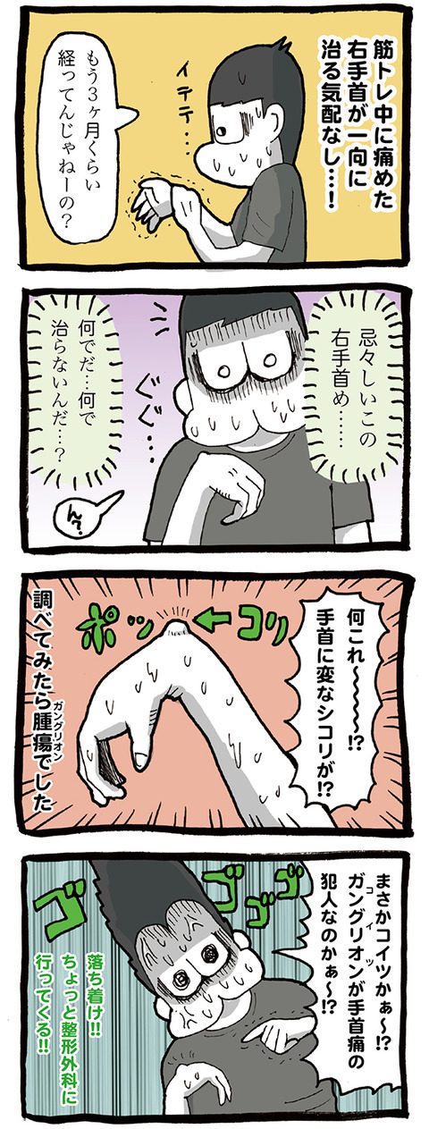右手首を痛めて3ヵ月。一向に治らない。その原因は腱鞘炎ではなくガングリオンだった…!のかもしれない