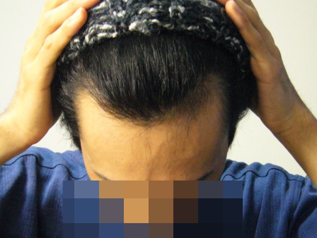 hair2010-04_02