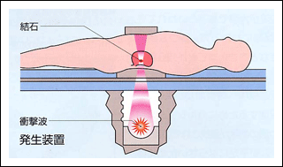 disease_hinyou_m3949c8c6
