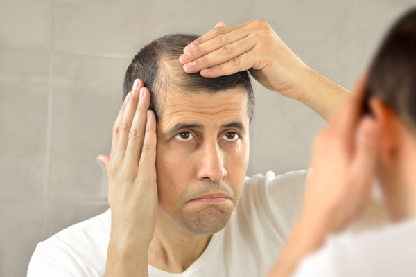 balding-and-greying001-thumb-720xauto