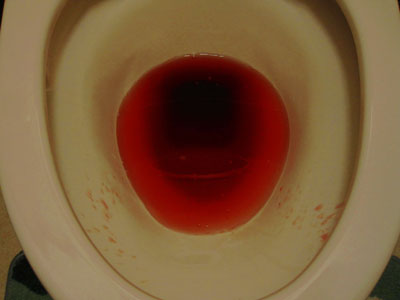 cd44dea98fab82fd1a0d64401dacef8d