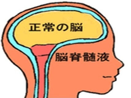 脳挫傷の後遺症か試験勉強で脳が痛む1