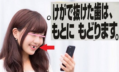 妻が前歯の差し歯が抜けた顔を自撮りした写真