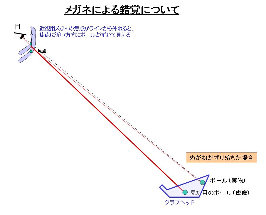 シャンク病には ひとりでこっそりシングルを目指す方法