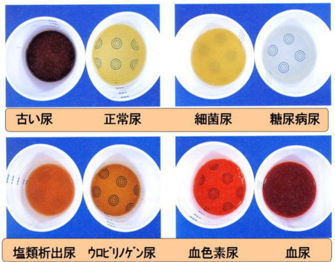 キャプチャ