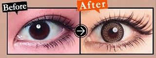 s-beforeafter