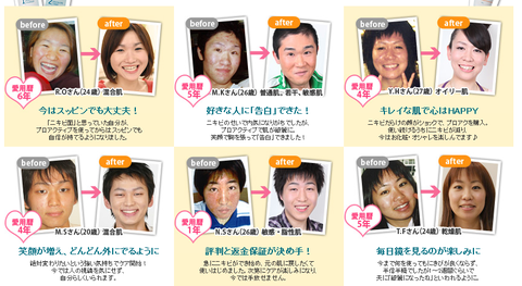 proactive02