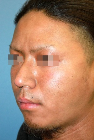 po1W斜め