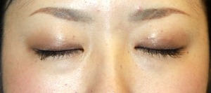 po1M閉瞼