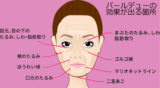 パールデューでリフトアップします。完璧に!a