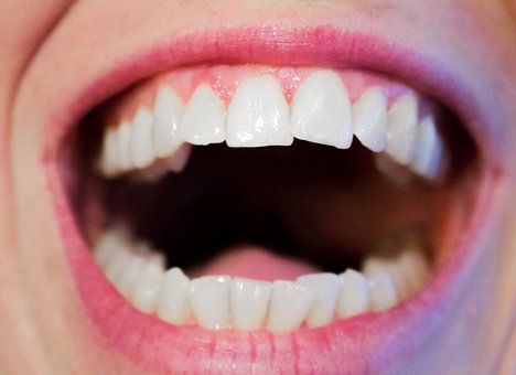 teeth-1652937__340