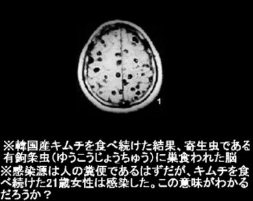 脳