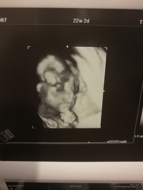 22w2d