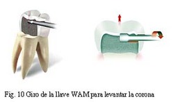 wam10