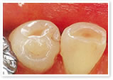 disease_img02