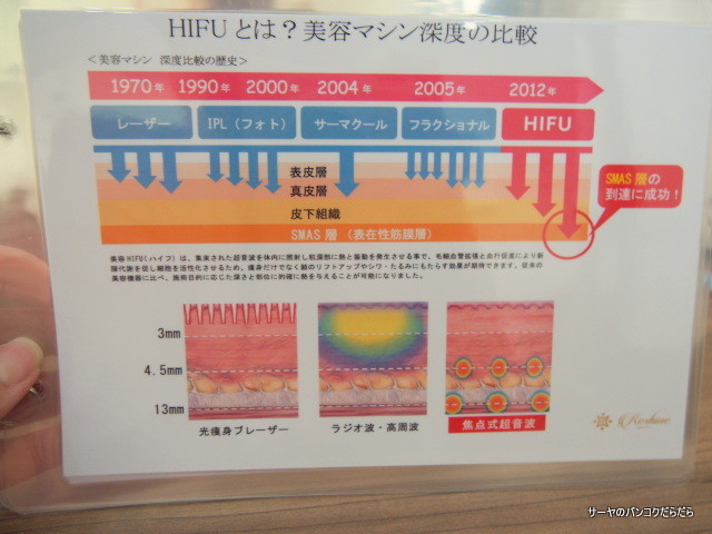 Rapi Rabi バンコク HIFU 格安 (4)
