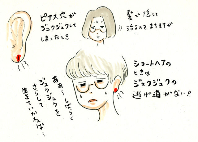 20170930ピアスのジュクジュク