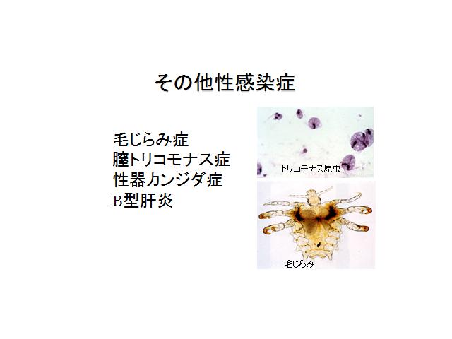 その他の性感染症