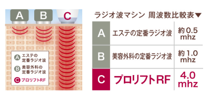 SnapCrab_NoName_2019-4-6_14-13-40_No-00