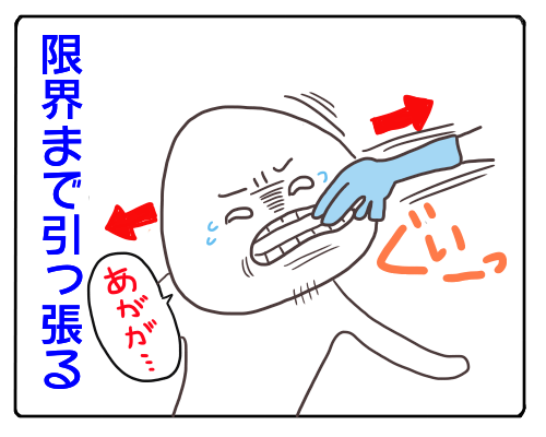 親知らず4