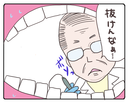 親知らず6