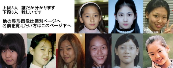 少女時代 整形