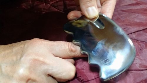 右手の人差し指の関節の曲がりが悪く痛いというので (2)